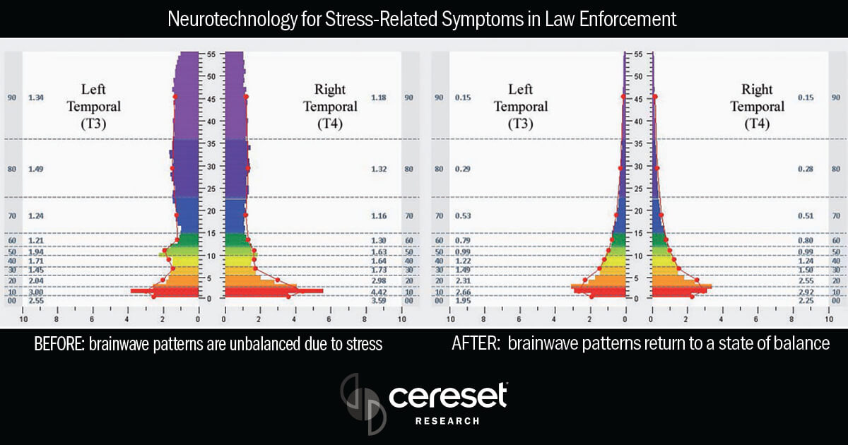 pilot-trial-of-a-noninvasive-closed-loop-neurotechnology pilot trial of a noninvasive closed loop neurotechnology