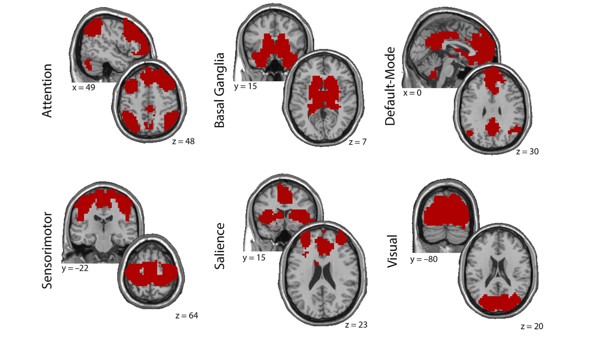 cereset-research-mri-brain-maps Cereset Research shares brain maps of brain functional connectivity laterality in military-related traumatic stress